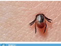 隨州市中心醫(yī)院提醒：小小蜱蟲需警惕！——發(fā)熱伴血小板減少綜合征科普知識(shí)